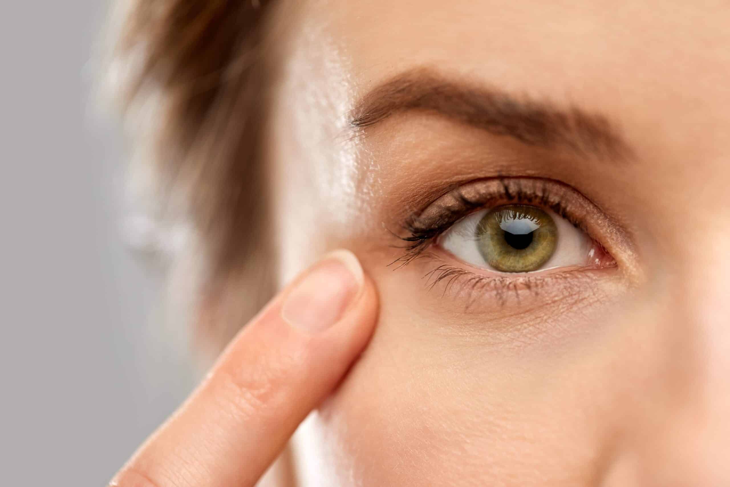 Effacer les poches sous les yeux grâce à la médecine esthétique | Dr Dellière | Rennes