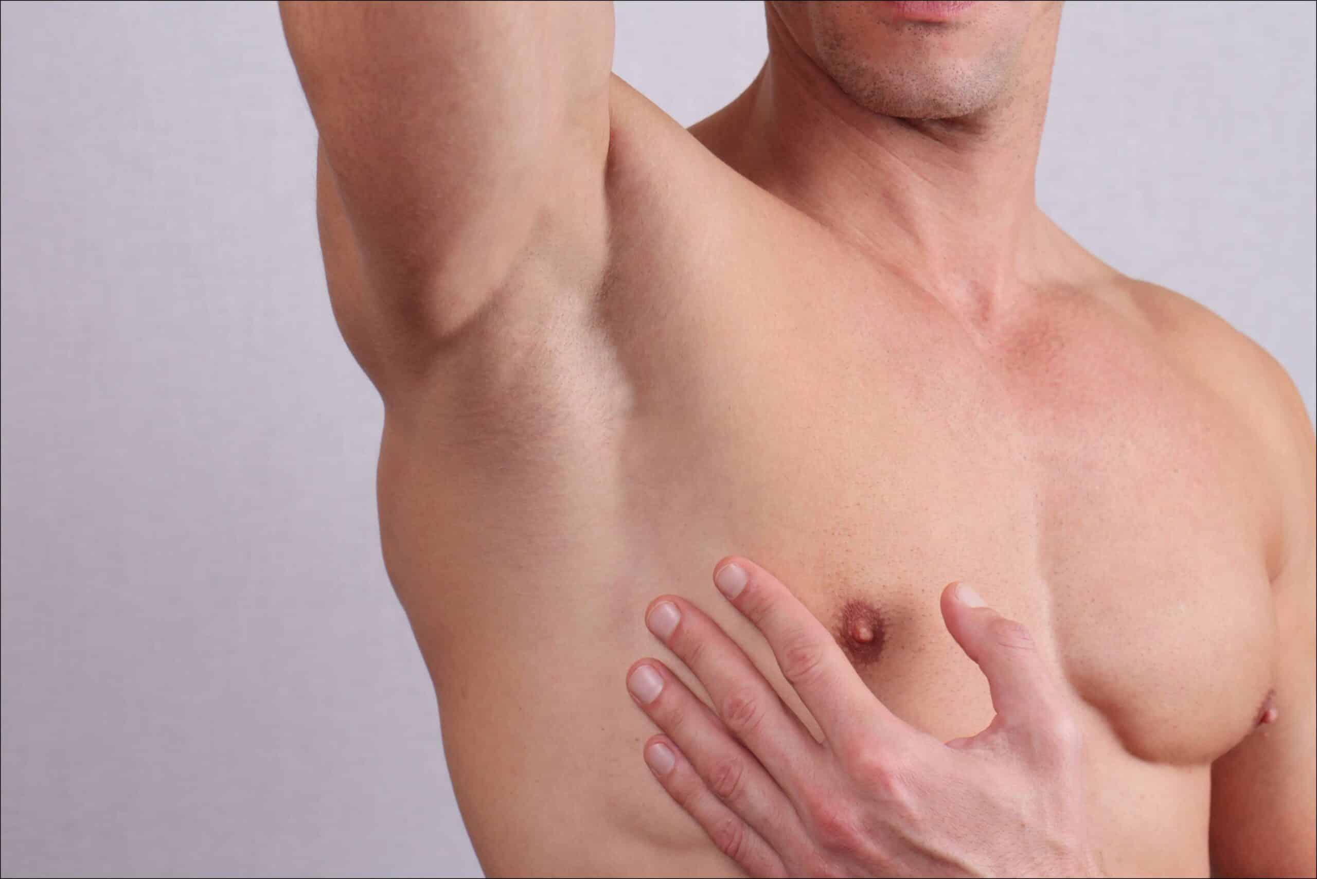 Epilation définitive pour homme | Dr Dellière | Rennes